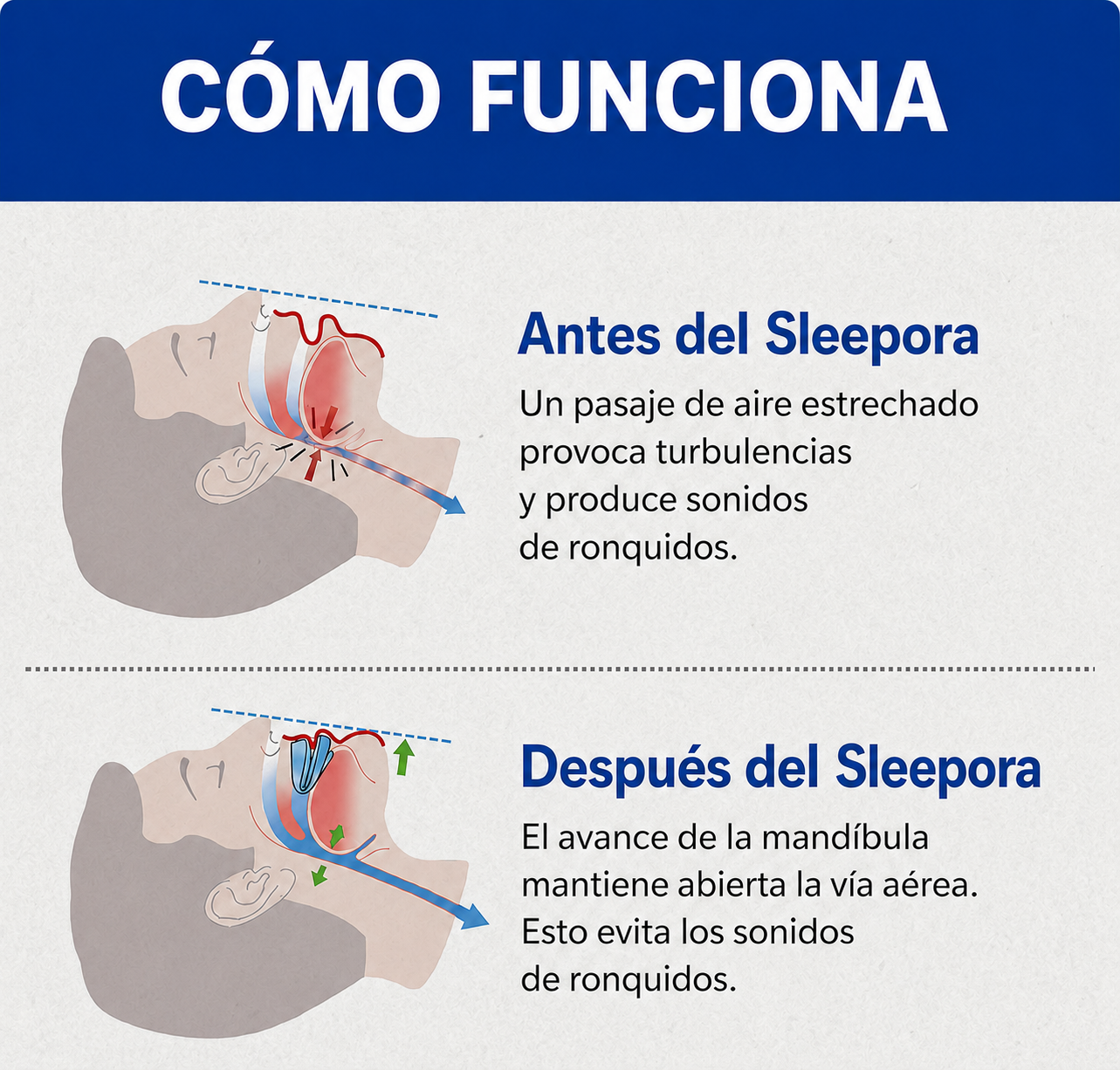 Sleepora™ Bucal Antironquido Universal